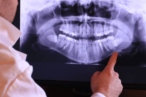 Best Emergency Denture Repair in Bulverde, TX